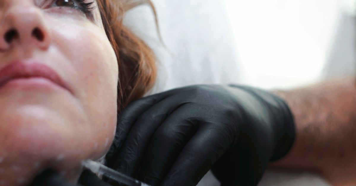 Merz Expands Belotero With Volume and Intense Fillers