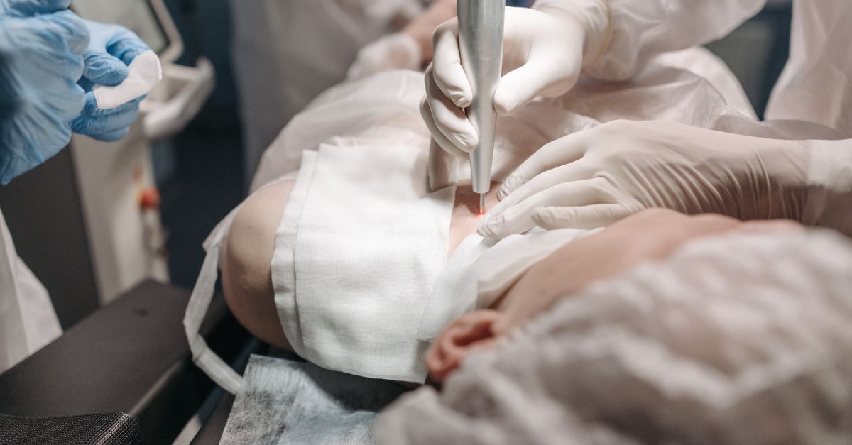 Merz Ultherapy PRIME Clears FDA for Knee Skin Laxity