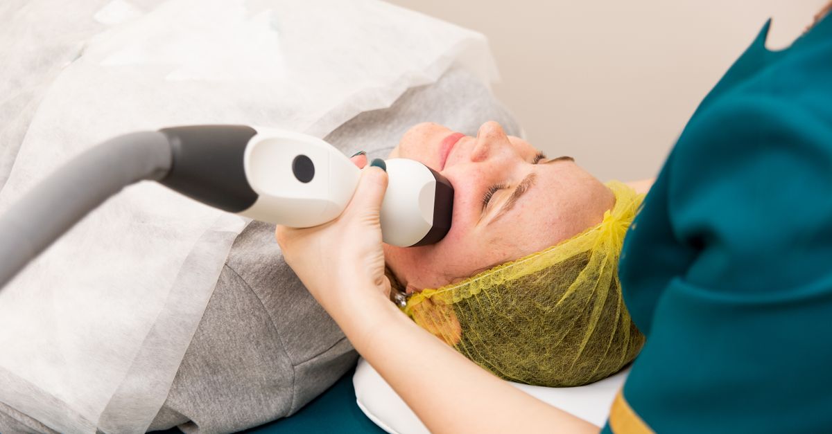 RF Microneedling Adverse Events Draw Clinical Review